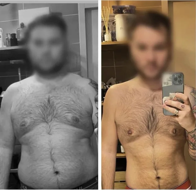 Avant / après de Armand, 26 ans